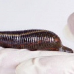 ГИРУДОТЕРАПИЯ в Клинике MED4YOU ГИРУДОТЕРАПИЯ в Клинике MED4YOU