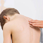 Детский сколиоз: когда необходимо обратиться к ортопеду Med4you 