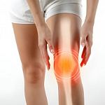 АРТРОЗ КОЛЕННОГО СУСТАВА АРТРОЗ КОЛЕННОГО СУСТАВА