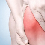 КОГДА БОЛЬ В КОЛЕНЕ ДОЛЖНА НАСТОРОЖИТЬ? КОГДА БОЛЬ В КОЛЕНЕ ДОЛЖНА НАСТОРОЖИТЬ?