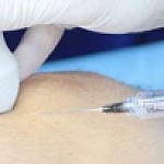 УЗИ навигация при блокадах и внутрисуставных инъекциях в Клинике MED4YOU