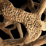 АНАЛИЗЫ: МАРКЕРЫ ОСТЕОПОРОЗА