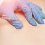 ЛЕЧЕБНЫЕ БЛОКАДЫ ЛЕЧЕБНЫЕ БЛОКАДЫ