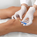 Внутрисуставные инъекции