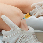 Плазмотерапия (PRP-терапия, ACP-терапия).