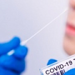 ПЦР ТЕСТ НА COVID-19 ПЦР ТЕСТ НА COVID-19