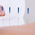 Фармакопунктура