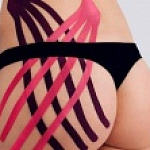 ТЕЙПИРОВАНИЕ ОТ ЦЕЛЛЮЛИТА