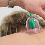 Рефлексотерапия