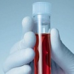 КАКИЕ БЫВАЮТ ТЕСТЫ НА КОРОНАВИРУС И КОГДА ИХ ДЕЛАТЬ?